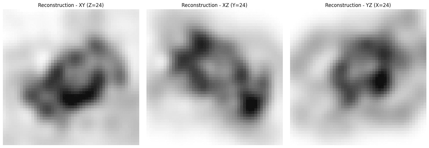 Three reconstruction orthoview panels