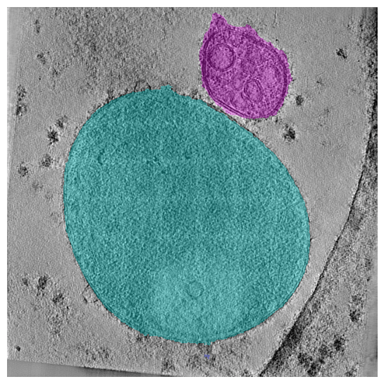 SABER 2D slab segmentation output